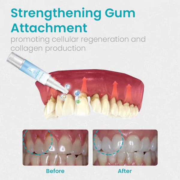 BioHarbor® Gum Shield Therapy Gel