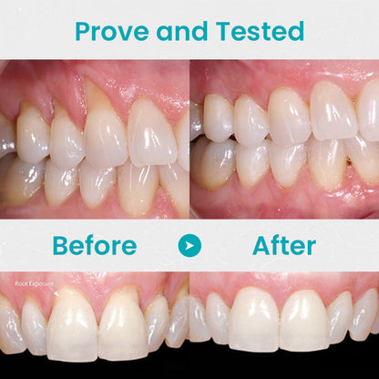 BioHarbor® Gum Shield Therapy Gel